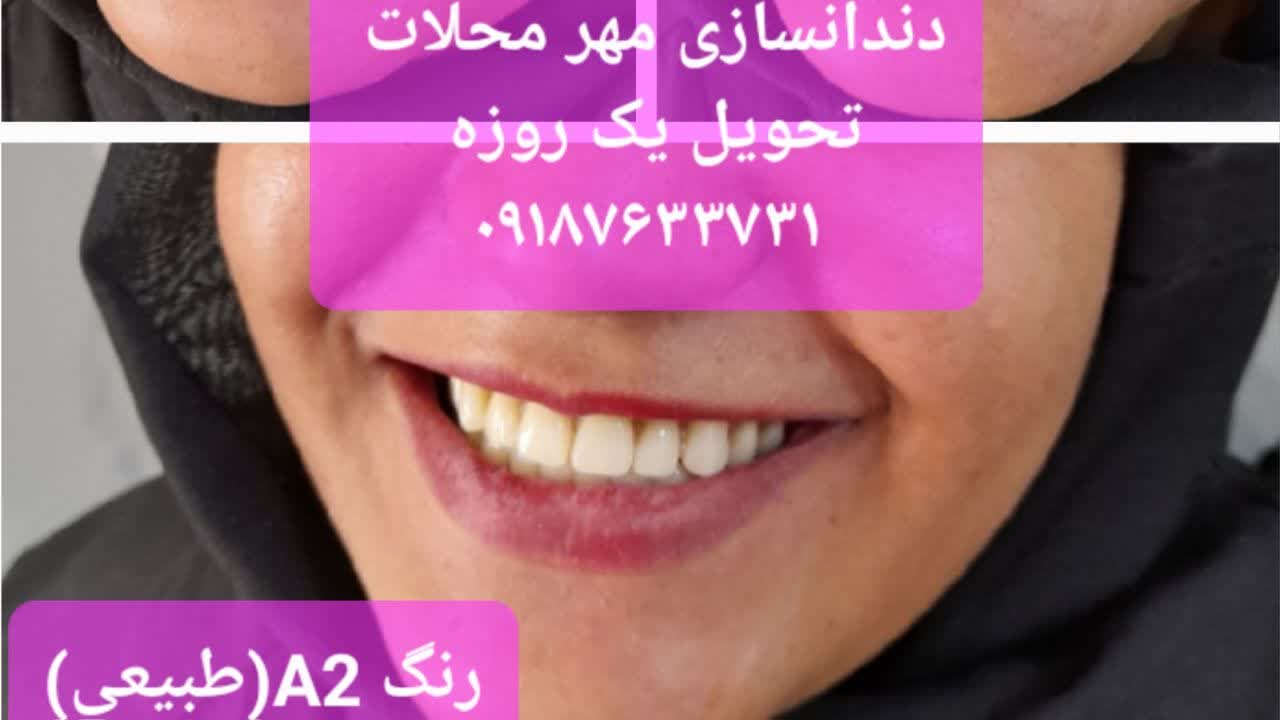 دندان سازی محلات